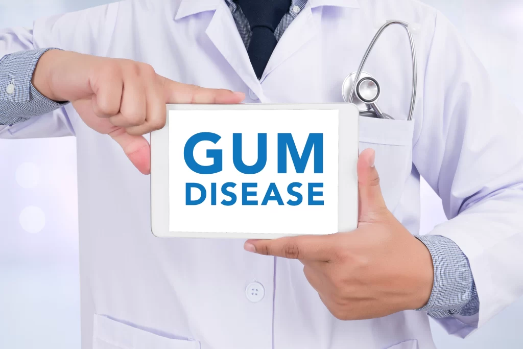 PERIODONTAL Disease MAINTENANCE